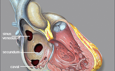 Curso de Ecocardiografia nas Cardiopatias Congênitas – Completo I, II e III