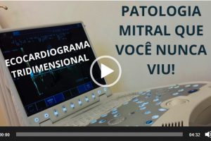 mitral_arcada