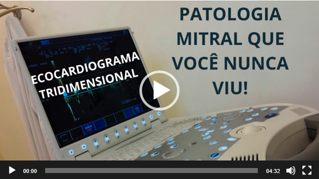 mitral_arcada
